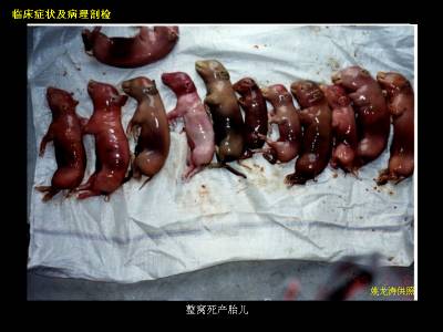 死胎